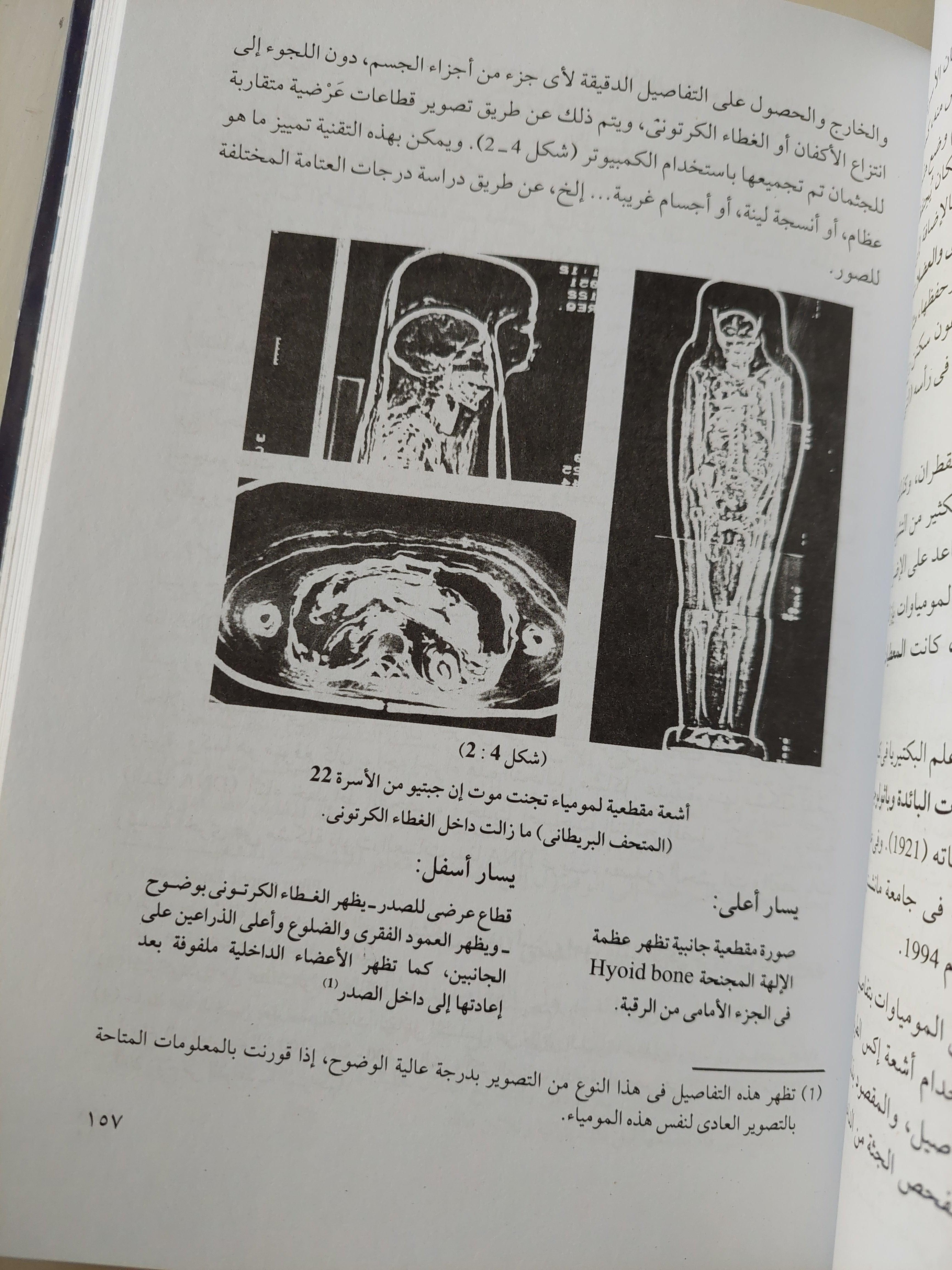 الطب المصري القديم / هارد كفر ملحق بالصور - متجر كتب مصر